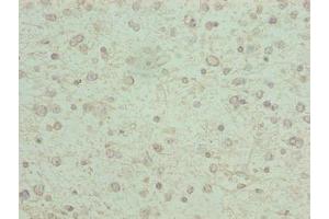 Immunohistochemistry (IHC) image for anti-Potassium Channel Subfamily K Member 13 (KCNK13) (AA 292-408) antibody (ABIN7163920)
