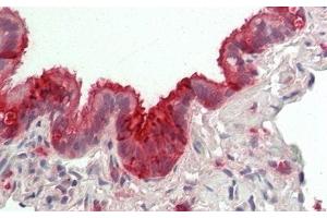 Detection of CC16 in Human Lung Tissue using Polyclonal Antibody to Clara Cell Protein 16 (CC16) (SCGB1A1 抗体  (AA 23-91))