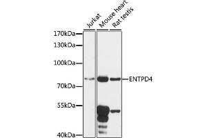Western blot analysis of extracts of various cell lines, using ENTPD4 antibody (ABIN7266893) at 1:1000 dilution. (ENTPD4 抗体  (AA 350-470))