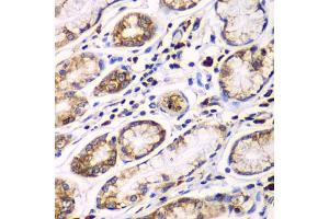 Immunohistochemistry of paraffin-embedded human colon using RPN1 antibody. (RPN1 抗体)