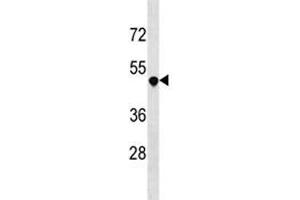 Western Blotting (WB) image for anti-Tumor Necrosis Factor Receptor Superfamily, Member 25 (TNFRSF25) (AA 214-242) antibody (ABIN3029372)