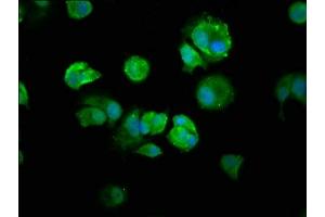 Immunofluorescence staining of MCF-7 cells with ABIN7161781 at 1:250, counter-stained with DAPI. (NFKB1 抗体  (AA 1-961))
