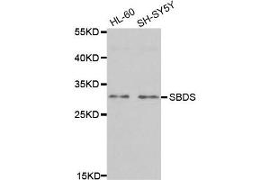 Western Blotting (WB) image for anti-Shwachman-Bodian-Diamond Syndrome (SBDS) antibody (ABIN1980243) (SBDS 抗体)