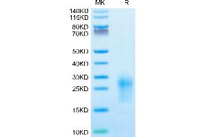 SDS-PAGE (SDS) image for T Cell Immunoreceptor with Ig and ITIM Domains (TIGIT) (AA 26-143) protein (His tag) (ABIN7275731)