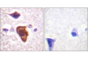 Immunohistochemistry analysis of paraffin-embedded human brain tissue, using CD88/C5aR (Ab-338) Antibody. (C5AR1 抗体  (AA 301-350))
