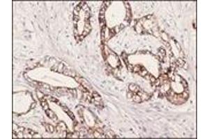 Immunohistochemistry (IHC) image for anti-Keratin 7 (KRT7) (C-Term) antibody (ABIN870436) (Cytokeratin 7 抗体  (C-Term))