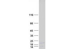 Western Blotting (WB) image for C1D Nuclear Receptor Corepressor (C1D) (Transcript Variant 2) protein (Myc-DYKDDDDK Tag) (ABIN2715442)