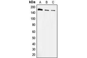 Western blot analysis of EEA1 expression in A431 (A), HeLa (B), THP1 (C) whole cell lysates.