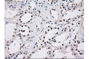 Immunohistochemical staining of paraffin-embedded endometrium tissue using anti-FHmouse monoclonal antibody. (FH 抗体)