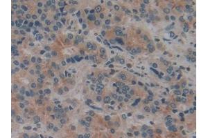 Immunohistochemistry (IHC) image for anti-Cylindromatosis (Turban Tumor Syndrome) (CYLD) (AA 170-338) antibody (ABIN7434896)