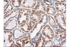 Immunohistochemical staining of paraffin-embedded Human liver tissue using anti-RAB17 mouse monoclonal antibody. (RAB17 抗体)