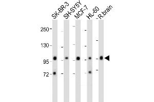 All lanes : Anti-PCDH20 Antibody (Center) at 1:2000 dilution Lane 1: SK-BR-3 whole cell lysate Lane 2: SH-SY5Y whole cell lysate Lane 3: MCF-7 whole cell lysate Lane 4: HL-60 whole cell lysate Lane 5: Rat brain whole cell lysate Lysates/proteins at 20 μg per lane. (PCDH20 抗体  (AA 445-472))