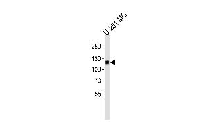 Western blot analysis of lysate from U-251 MG cell line, using EphA5 Antibody (ABIN387809 and ABIN2843902). (EPH Receptor A5 抗体)