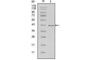Western Blot showing LAMB1 antibody used against truncated LAMB1-His recombinant protein (1). (Laminin 抗体  (AA 31-270))