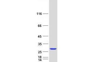 Western Blotting (WB) image for RAB39B, Member RAS Oncogene Family (RAB39B) protein (Myc-DYKDDDDK Tag) (ABIN2730347)