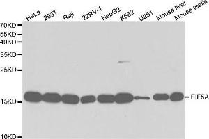 Western blot analysis of extracts of various cell lines, using EIF5A antibody. (EIF5A 抗体  (AA 1-154))
