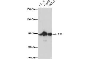 Western blot analysis of extracts of various cell lines, using  Rabbit mAb (ABIN7265571) at 1:1000 dilution. (ALAS1 抗体)
