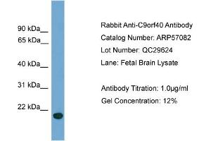 WB Suggested Anti-C9orf40  Antibody Titration: 0. (C9orf40 抗体  (Middle Region))