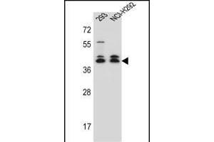 DMRTC2 Antibody (Center) (ABIN657024 and ABIN2846201) western blot analysis in 293,NCI- cell line lysates (35 μg/lane). (DMRTC2 抗体  (AA 99-128))