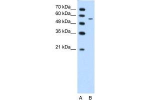 WB Suggested Anti-CHST7 Antibody Titration:  1. (CHST7 抗体  (Middle Region))