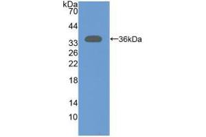 Western blot analysis of recombinant Rat NT5C3. (NT5C3 抗体  (AA 8-289))