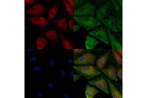ABIN6260104 and ABIN6278139 staining  cells by IF/ICC.