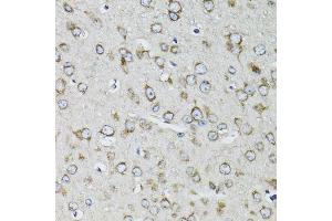 Immunohistochemistry of paraffin-embedded mouse brain using RPS10 antibody. (RPS10 抗体  (AA 1-165))
