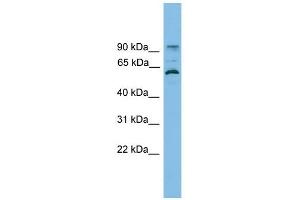 ANKRD5 antibody used at 1 ug/ml to detect target protein. (ANKRD5 抗体  (N-Term))