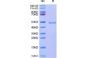 Leptin Protein (LEP) (AA 22-167) (Fc Tag)