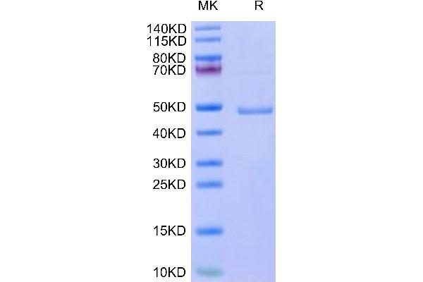 Leptin Protein (LEP) (AA 22-167) (Fc Tag)