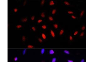 Immunofluorescence analysis of U2OS cells using COMMD1 Polyclonal Antibody at dilution of 1:100. (COMMD1 抗体)