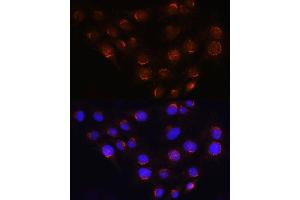 Immunofluorescence analysis of C6 cells using GOLG Rabbit pAb (ABIN6129790, ABIN6141266, ABIN6141267 and ABIN6214379) at dilution of 1:100 (40x lens). (GOLGA4 抗体  (AA 1-150))