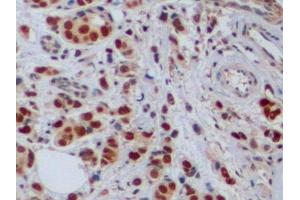 Immunohistochemistry (IHC) image for anti-Proliferating Cell Nuclear Antigen (PCNA) (AA 6-261) antibody (ABIN7443113)