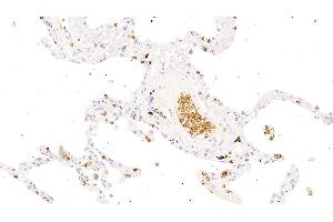 Detection of GYPA in Human Lung Tissue using Polyclonal Antibody to Glycophorin A (GYPA) (CD235a/GYPA 抗体  (AA 20-91))