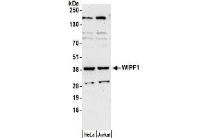 Western Blotting (WB) image for anti-WAS/WASL Interacting Protein Family, Member 1 (WIPF1) (AA 150-200) antibody (ABIN7450906)