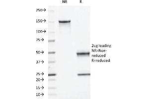 SDS-PAGE (SDS) image for anti-Moesin (MSN) antibody (ABIN6940085)