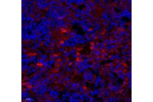 Immunofluorescence (Paraffin-embedded Sections) (IF (p)) image for anti-Coiled-Coil Domain Containing 147 (CCDC147) antibody (ABIN7073535)