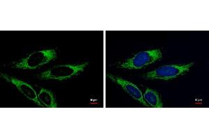 ICC/IF Image Adenylate kinase 3 antibody [N1C3] detects Adenylate kinase 3 protein at mitochondria by immunofluorescent analysis. (AK4 抗体)