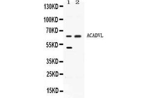 Western blot analysis of ACADVL expression in rat liver extract ( Lane 1) and HELA whole cell lysates ( Lane 2). (ACADVL 抗体  (C-Term))