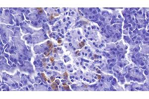 Detection of PDLIM1 in Human Pancreas Tissue using Polyclonal Antibody to PDZ And LIM Domain Protein 1 (PDLIM1) (PDLIM1 抗体  (AA 2-329))