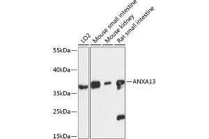Western blot analysis of extracts of various cell lines, using  antibody (ABIN6127437, ABIN6136922, ABIN6136923 and ABIN6217829) at 1:3000 dilution. (Annexin A13 抗体  (AA 1-316))