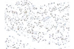 Immunocytochemistry (ICC) image for anti-AT Rich Interactive Domain 1A (SWI-Like) (ARID1A) (AA 750-800) antibody (ABIN7795678) (Recombinant ARID1A 抗体  (AA 750-800))