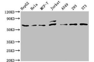 Western Blot Positive WB detected in: HepG2 whole cell lysate, Hela whole cell lysate, MCF-7 whole cell lysate, Jurkat whole cell lysate, A549 whole cell lysate, 293 whole cell lysate, NIH/3T3 whole cell lysate All lanes: c-FOS antibody at 0. (Recombinant c-FOS 抗体)
