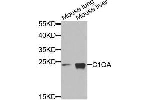 Western blot analysis of extracts of mouse lung and mouse liver cells, using C1QA antibody. (C1QA 抗体)