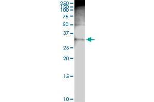 Immunoprecipitation of PRKRA transfected lysate using anti-PRKRA MaxPab rabbit polyclonal antibody and Protein A Magnetic Bead , and immunoblotted with PRKRA purified MaxPab mouse polyclonal antibody (B01P) .