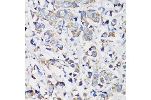 Immunohistochemistry (IHC) image for anti-Cyclin B1 (CCNB1) (C-Term) antibody (ABIN7266555)