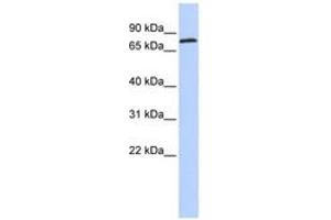 Image no. 1 for anti-Zinc Finger Protein 613 (ZNF613) (AA 35-84) antibody (ABIN6742887) (ZNF613 抗体  (AA 35-84))