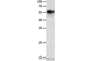 Western blot analysis of Hela cell, using CHRNA3 Polyclonal Antibody at dilution of 1:600 (CHRNA3 抗体)