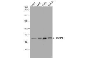 WB Image UGT1A6 antibody detects UGT1A6 protein by western blot analysis. (UGT1A6 抗体  (Center))