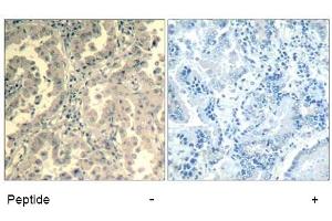 Image no. 2 for anti-Signal Transducer and Activator of Transcription 2, 113kDa (STAT2) (Tyr690) antibody (ABIN319410) (STAT2 抗体  (Tyr690))